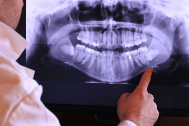 Best Chipped Tooth Repair Near Me  in Fowlerville, MI