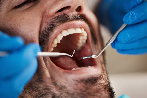 Best Chipped Tooth Repair Near Me  in Fowlerville, MI